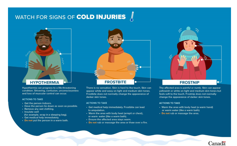 Cold injuries to watch for in winter