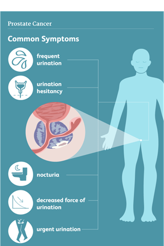 Prostate health: Early detection and prevention | Ridgeback Student Voices
